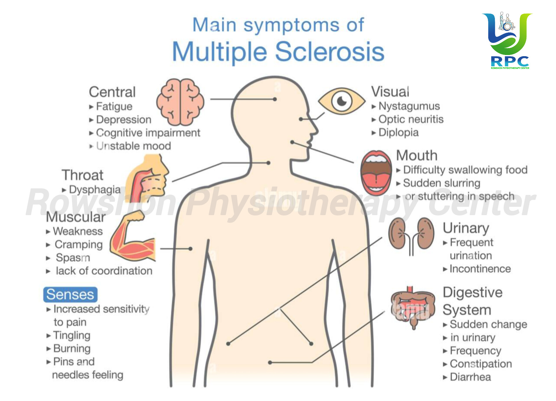 Multiple Sclerosis: একটি দীর্ঘমেয়াদী স্নায়বিক সমস্যা